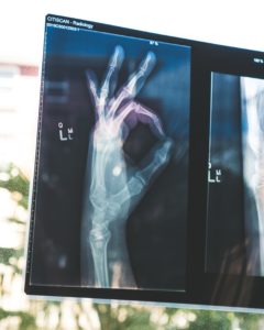 Things To Consider When Signing Up For Health Insurance